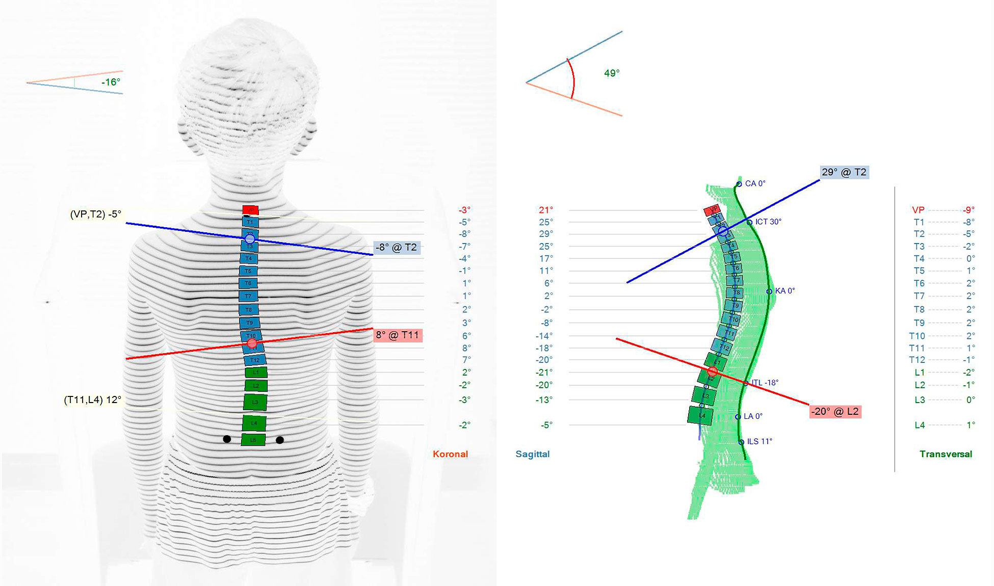 PML, Wirbelsäulenvermessung PML Biomechanische Ausstattung Wirbelsäulenvermessung